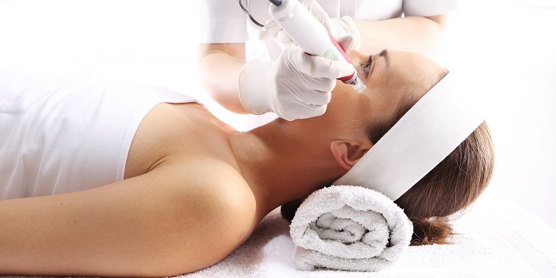 micro needling for acne scars